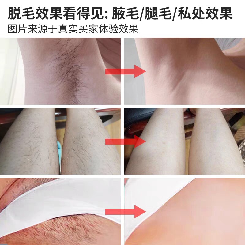 推毛器推子私处男局部电推剪刮刀脱毛肛毛女腋毛修剪腿毛电动