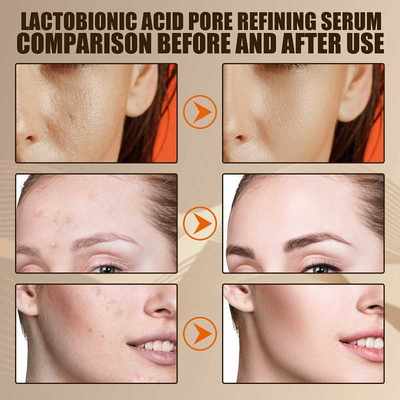 新品Lactobionic Acid Pore Shrink Face Serum Hyaluronic Acid