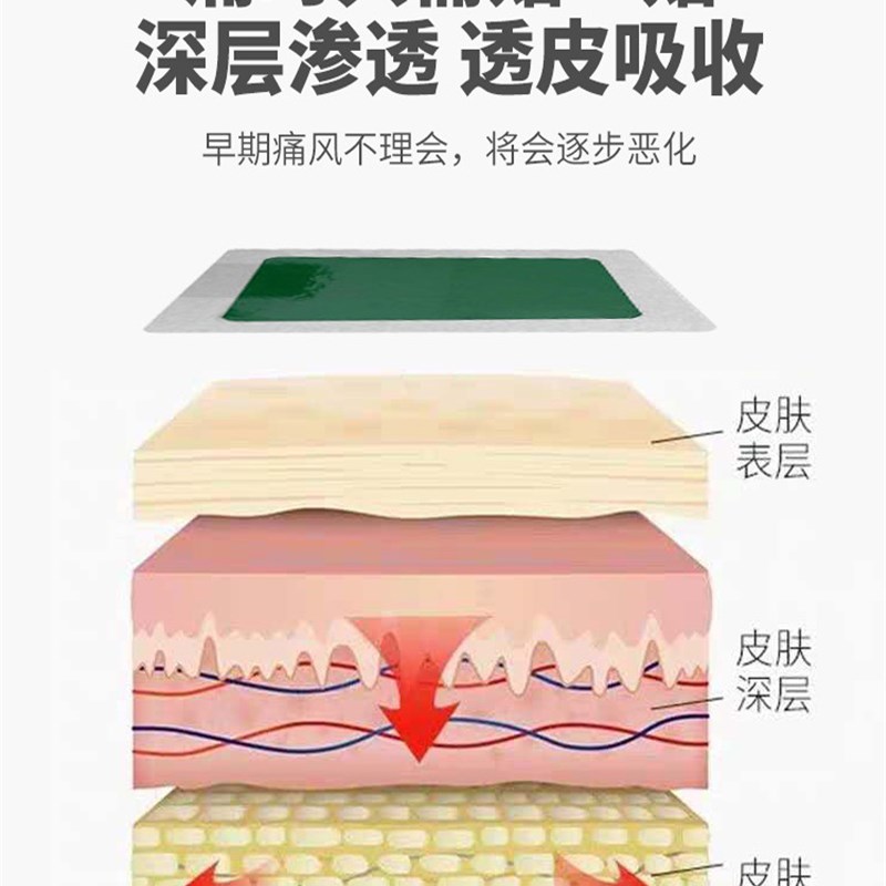 厂家治疗新版痛风特效药缅甸关y节疼...