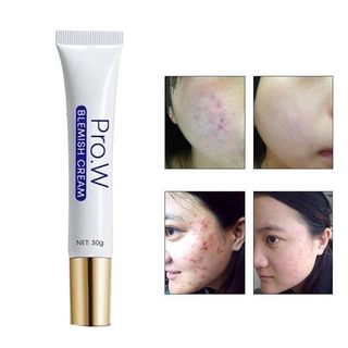 速发Pro. w clareamento creme de rosto da acne no rosto remov