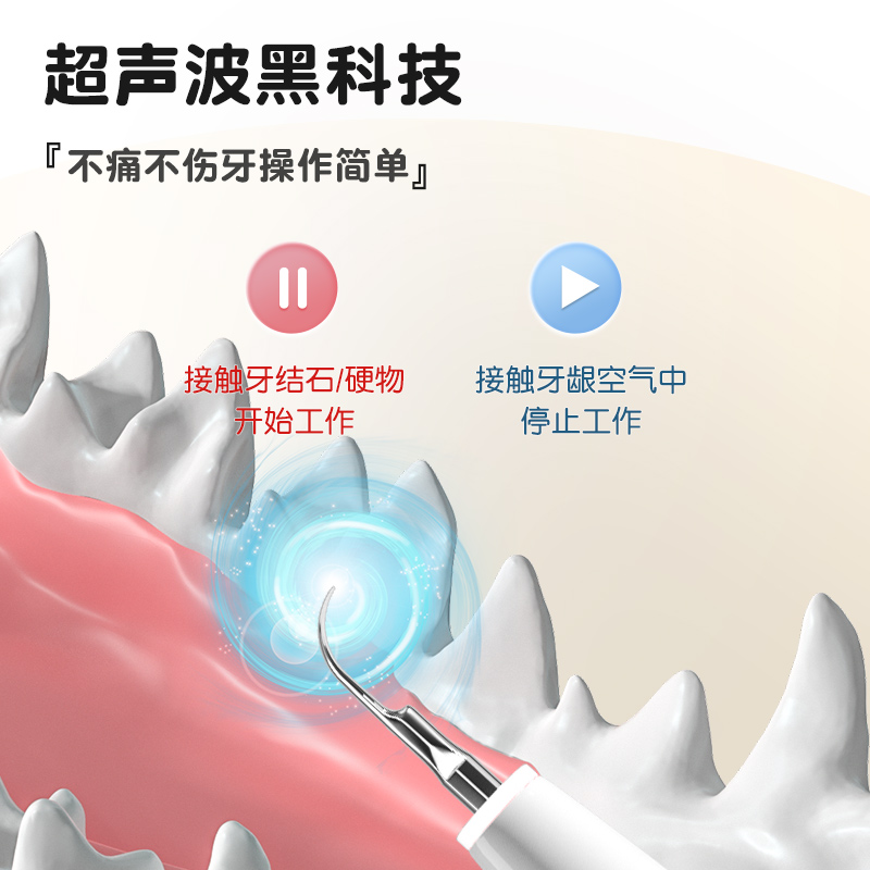 狗狗牙结石去除器超声波洁牙仪机宠物猫咪牙齿清洁神器狗去洗牙器