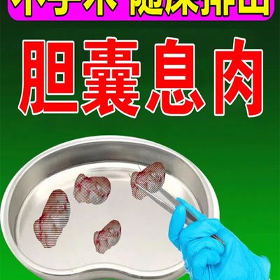 速发胆囊息肉中药贴治疗泥沙样结石溶石化石胆囊炎腹胀腹痛专用神