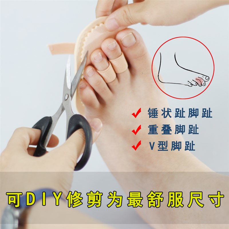 工厂销脚趾矫正垫拇外q翻脚趾重叠脚趾分趾器锤状指弯曲变形