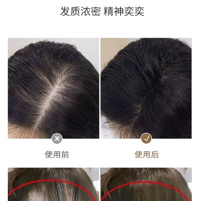 新品珂芝雅漂何首乌派防脱育发洗发水小金菲控油去屑止痒官方旗舰