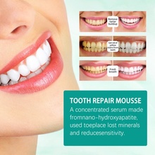 Toothpaste Mousse Whiten Deep 速发Teeth Cleaning Whitening