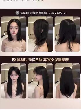 【不用带发网的假发】手织蕾丝头顶补发片隐形无痕全头发两边遮白