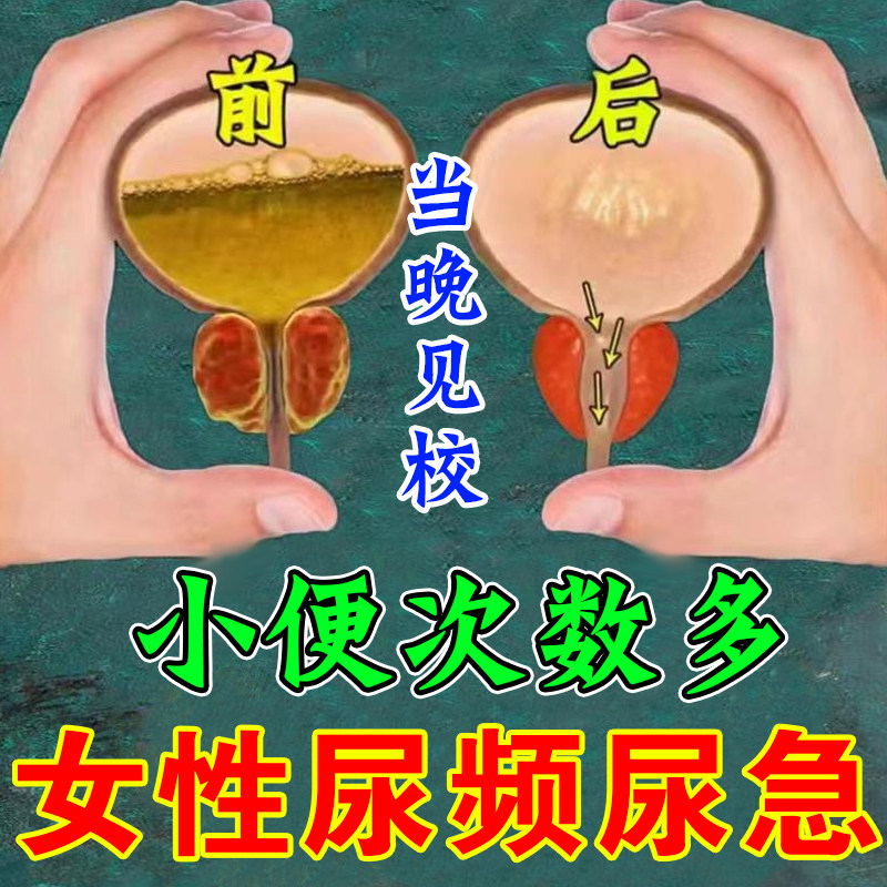 厂家女性夜尿多小便次数多夜频起尿多尿频尿急尿不尽中草药肚脐贴