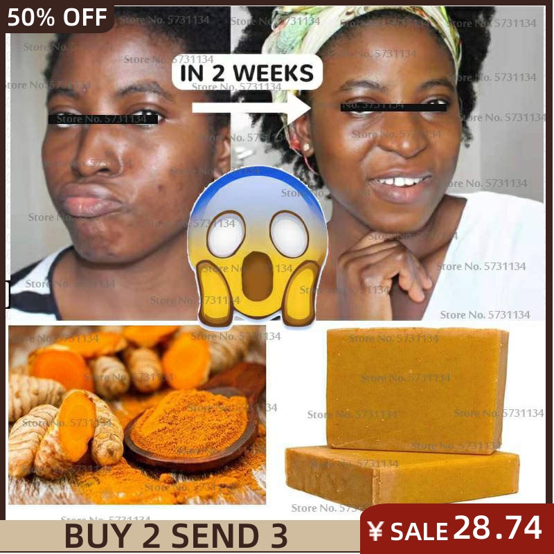 推荐Tumeric Soap Natural To Lightening Acne Dark Spots Skin