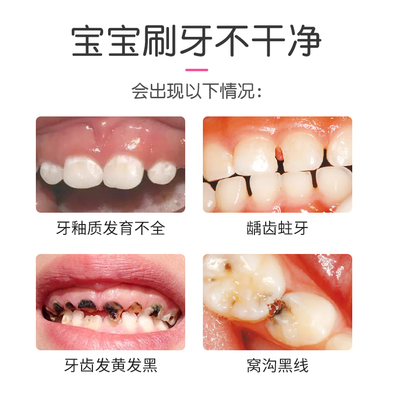 日本狮王儿童牙膏含氟0-3一12牙菌斑白斑脱矿6岁以上Y勿吞咽可防