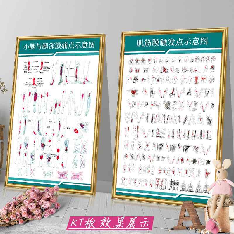 肌筋膜疼痛触发点挂图人体激痛点示意图中医院医学海报宣传画墙贴
