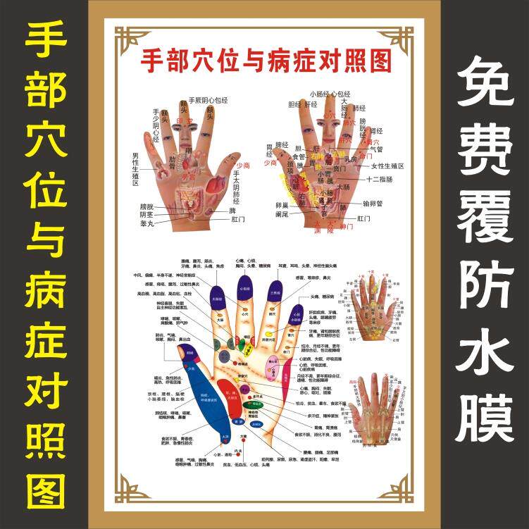 手按摩穴位图手部反射区大挂图人体针灸手部穴位与病症对照图墙贴