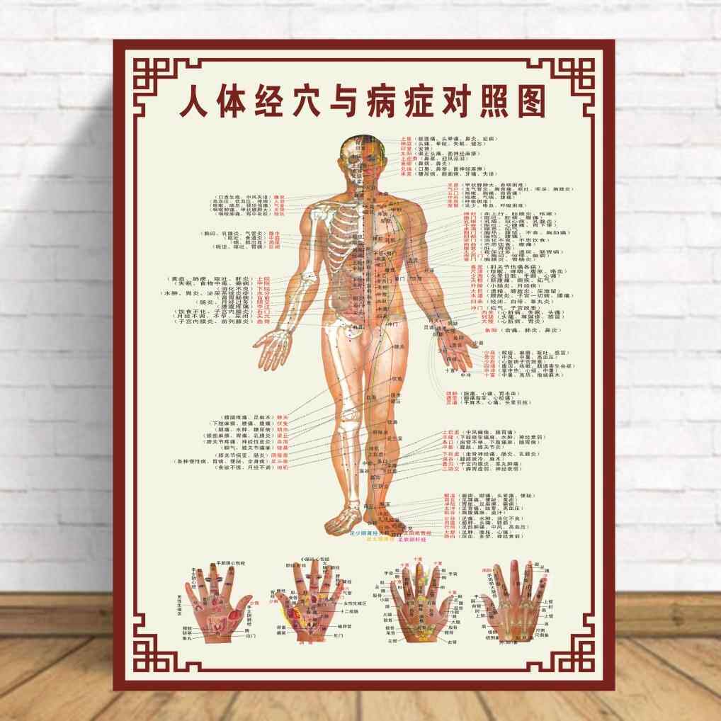 中医养生人体经穴与病症对照图经络穴位针炙对照高清海报超大挂图
