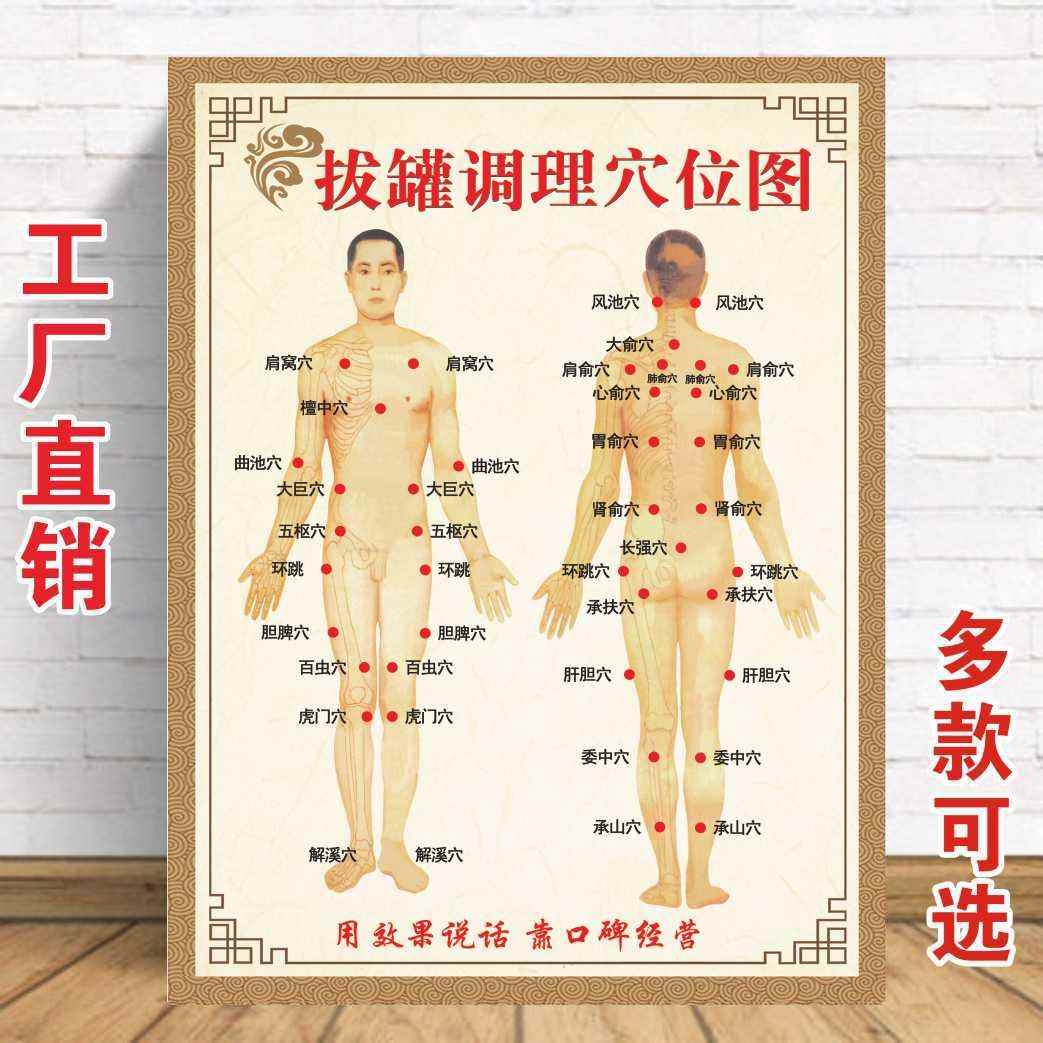 中医养生拔罐穴位调理图宣传广告装饰展板拔罐穴位海报贴画墙贴画