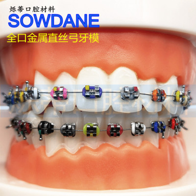 牙科牙模型正畸模型白色标准全金属模型齿科医患沟通