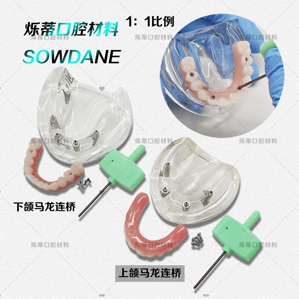 牙科口腔教学模型马龙连桥义齿修复模型上颌下颌仿真义齿种植模型