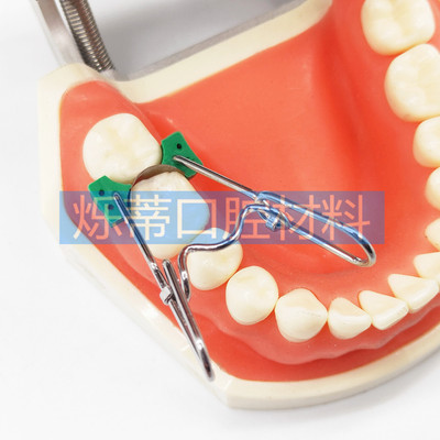 牙科弹力夹子成形片夹口腔护理