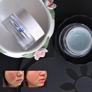 直接把脸盘活了！美小狐蓝铜胜肽面霜修红敏焕新皮屏障受损救烂脸