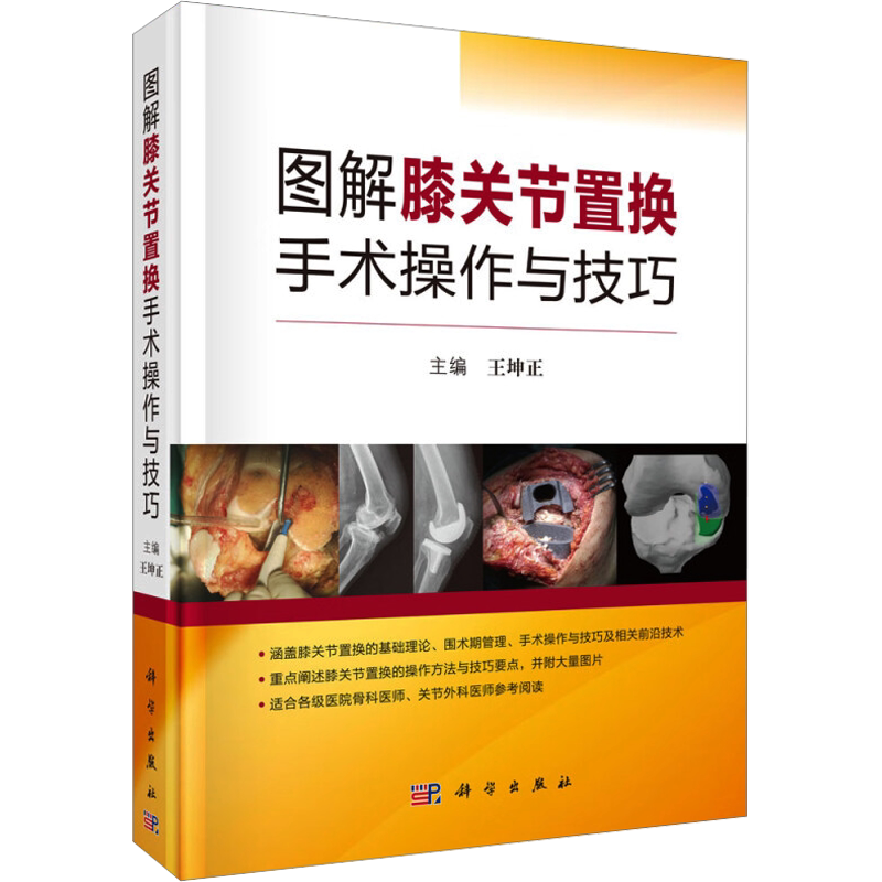 图解膝关节置换手术操作与技巧 正版书籍 新华书店旗舰店文轩官网 科学出版社