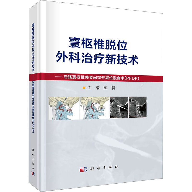 寰枢椎脱位外科治疗新技术——后路寰枢椎关节间撑开复位融合术(PFDF) 正版书籍 新华书店旗舰店文轩官网 科学出版社