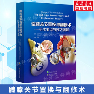 髋膝关节置换与翻修术——手术要点与技巧图解 正版书籍 新华书店旗舰店文轩官网 山东科学技术出版社
