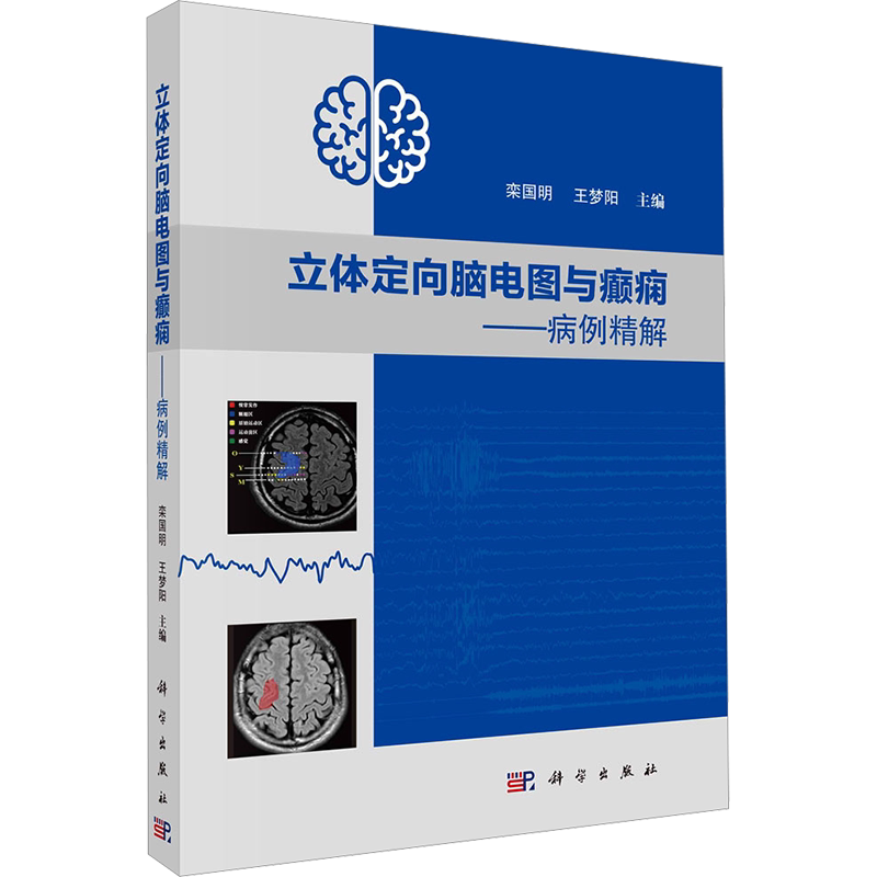 立体定向脑电图与癫痫——病例精解 正版书籍 新华书店旗舰店文轩官网 科学出版社