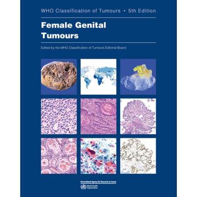 现货 英文原版 女性生殖器肿瘤 Female Genital Tumours: Who Classification of Tumours