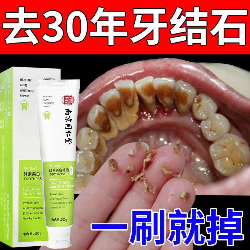 正品】南京同仁堂秒去除牙结石溶解牙石烟渍垢清洁美牙白去黄去口,洗护清洁剂/卫生巾/纸/香薰,牙膏,淘宝优惠券,粉丝福利购,淘宝优惠卷