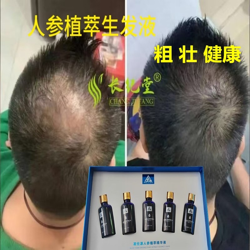发仕源人参养发精华液生发防掉发固发浓密粗壮斑超浓缩增发精萃液