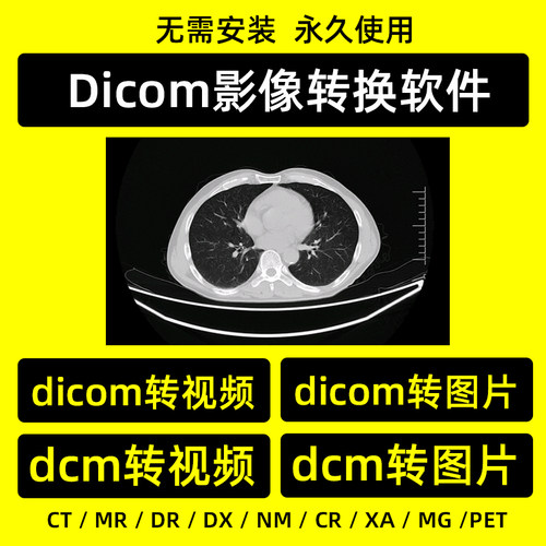 dicom格式转换软件dcm转视频mp4转图片jpg医学影像工具云胶片转换