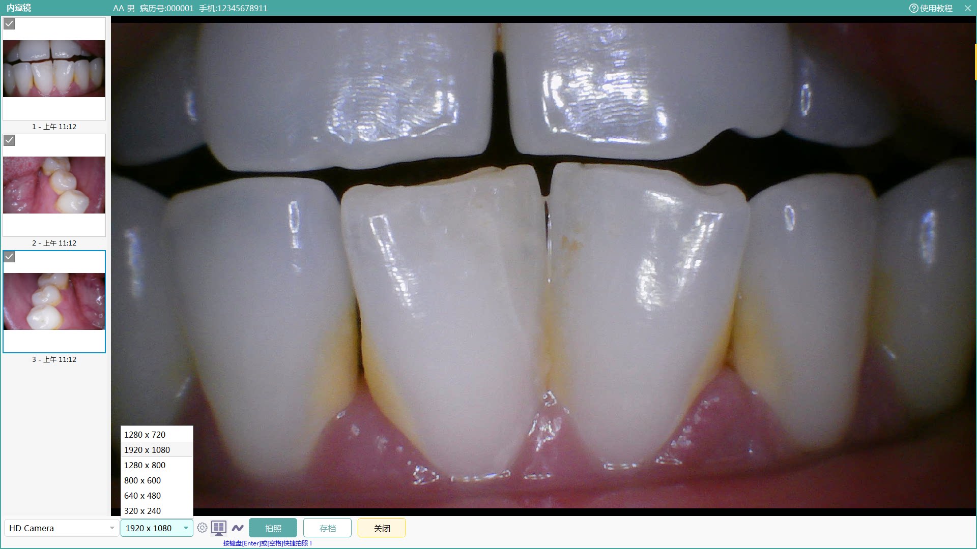 16세 매장 1080P USB 구강 내 카메라 컴퓨터 태블릿 안드로이드 APPLE 등 무료 소프트웨어 U 디스크