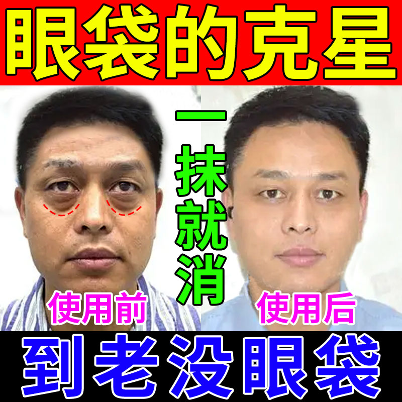 眼袋去除神器男士精华液眼霜官方旗舰店正品眼部精油抗皱紧致专用