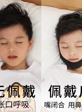 腺样体肥大面容矫正器儿童闭嘴器