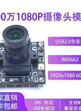 200万1080P像素60帧摄像头模组usb2.0免驱摄像头模块IMX662