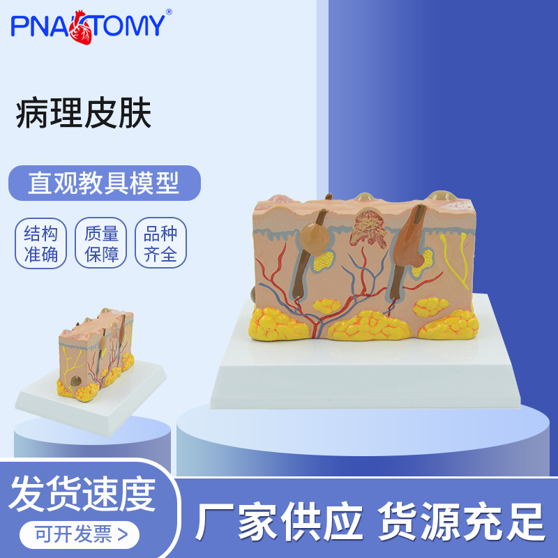 医学教学病理皮肤解剖模型皮肤病学病理机制分析临床诊断实训教具