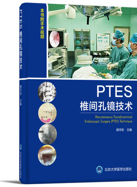 PTES椎间孔镜技术