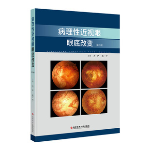 病理性近视眼眼底改变（第二版）