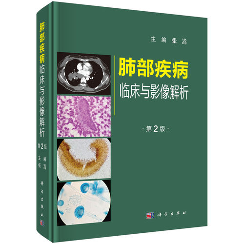 肺部疾病临床与影像解析（第二版）