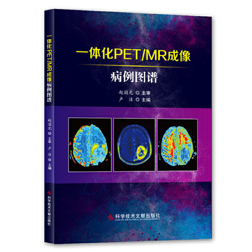 一体化PET/MR成像病例图谱