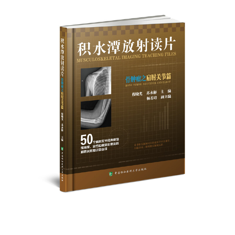 当当网 积水潭放射读片——骨肿瘤之上肢篇 程晓光 苏永彬 中国协和医科大学出版社 正版书籍
