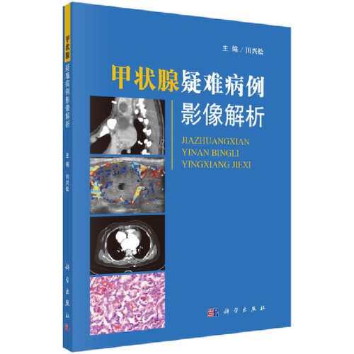 当当网 甲状腺疑难病例影像解析 医学 科学出版社 正版书籍