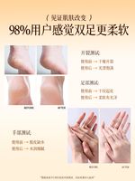 CandyMoyo Honey Ginger Foot Cream Moisturizes and nourishes cracked and rough heels for autumn and winter. 110g large capacity thumbnail 4