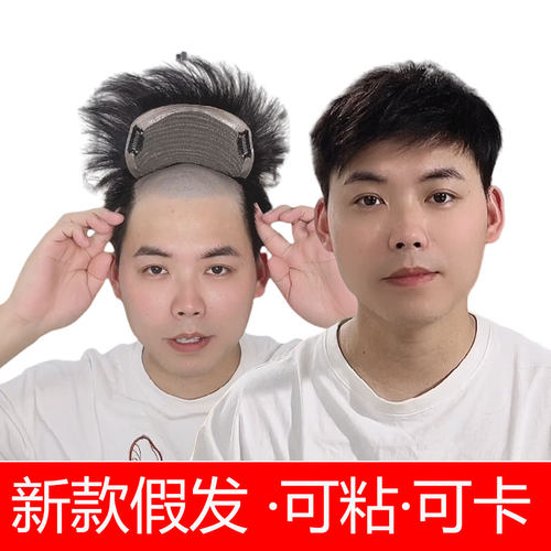 假发男士真发补发片遮盖秃顶假发