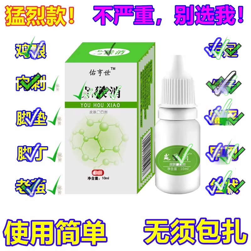 跖消灵去肉刺凸起肉刺去除膏去鱼鳞膏手猴的药脚眼老茧脚垫手脚趾