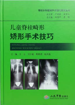 儿科脊柱畸形矫形手术技巧(脊柱外科疑难手术技巧系列丛书