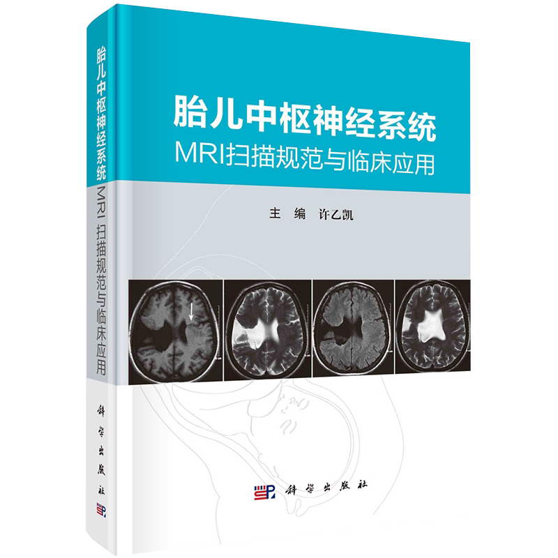 胎儿中枢神经系统MRI扫描规范与临床应用主编许乙凯科学出版社9787030684813