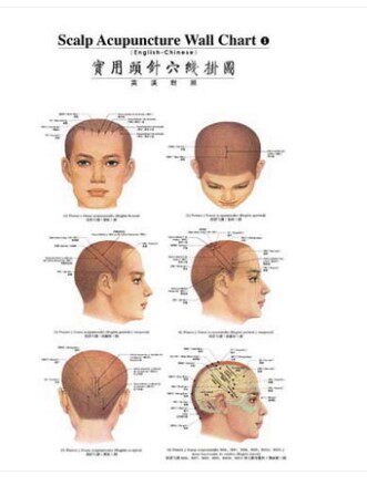 实用头针穴线挂图（德汉对照）外销书
