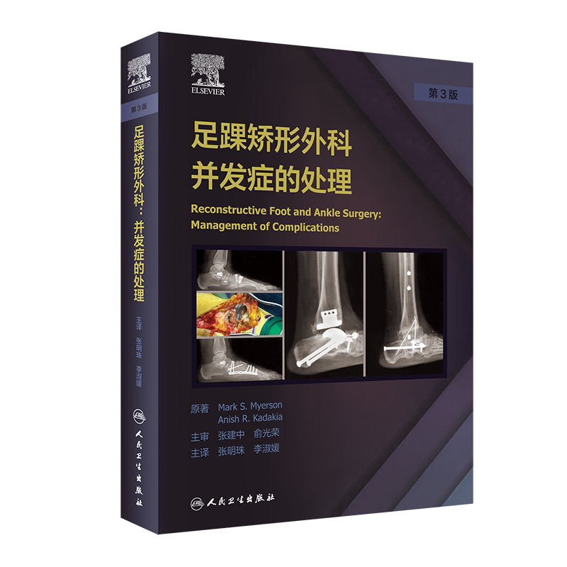 现货正版足踝矫形外科 并发症的处理 第3版 翻译版 张明珠 李淑媛人民卫生出版社9787117319409
