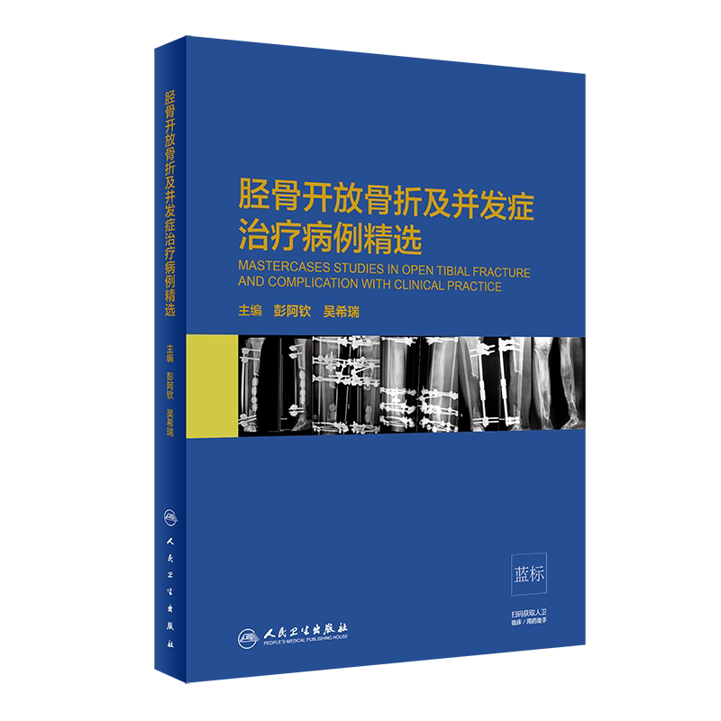 现货 胫骨开放骨折及并发症治疗病例精选彭阿钦吴希瑞人民卫生出版社
