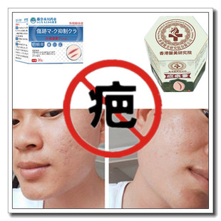 消除去增生性冻疮疙瘩祛缝针手术产后开伤疤痕印灵黑色素回流药膏