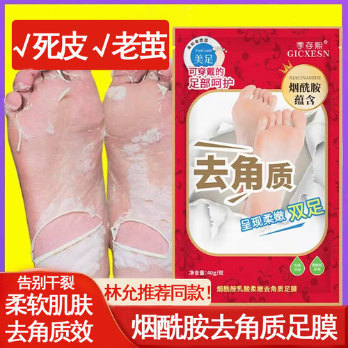 烟酰胺足膜去死皮老茧嫩白脚部护